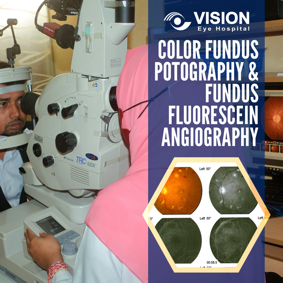 Color Fundus Photography CFA-FFA Topcon