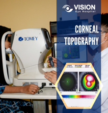 Corneal Topography