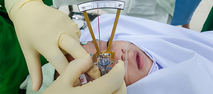 PEDIATRIC OPHTHALMOLOGY